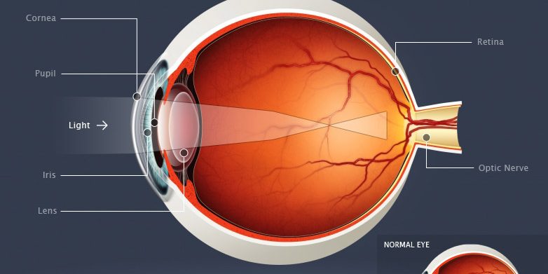 Laser μυωπίας - υπερμετρωπίας